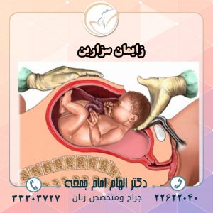 زایمان-سزارین (2)